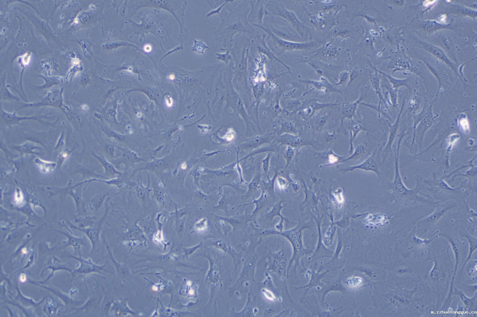 day 5 新生小鼠心肌成纤维细胞.jpg