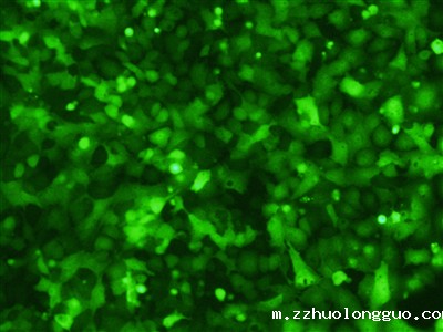 慢病毒感染细胞