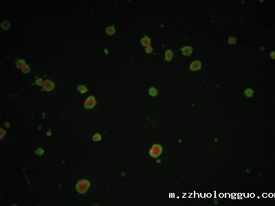 膜免疫荧光法检测血清水痘