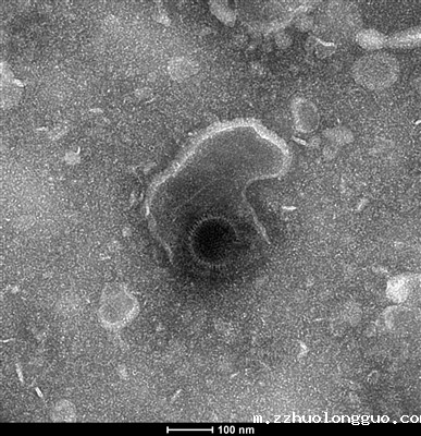 透射电镜观察HCMV形态